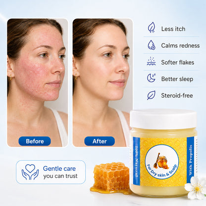 Repair Balm For Eczema & Psoriasis