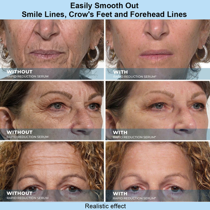 OUR+™ Instant Face Temporary Tightener – Instant visible results in 30 seconds