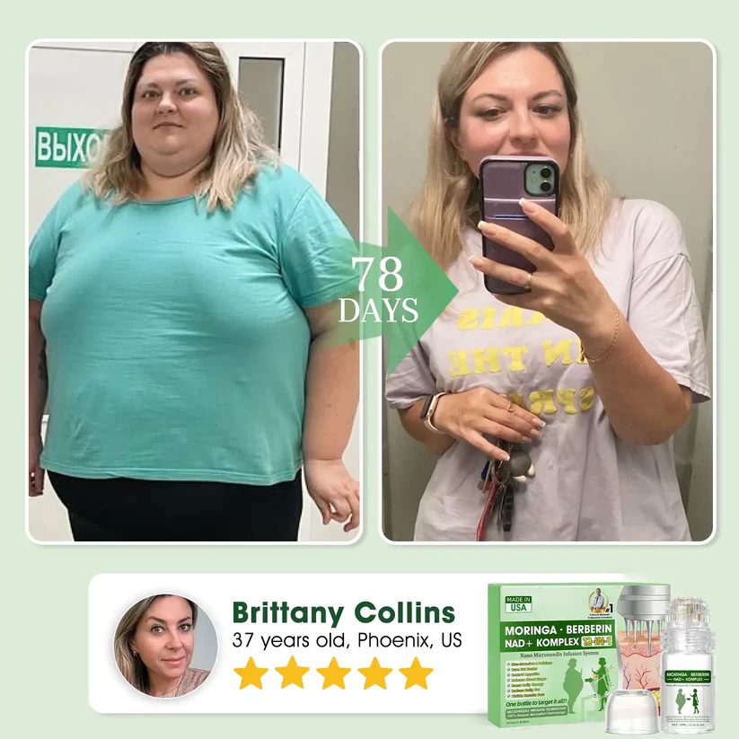 【𝐎𝐟𝐟𝐢𝐜𝐢𝐚𝐥 𝐔𝐒 𝐒𝐭𝐨𝐫𝐞】 ✔️ OUR+® Nano Microneedle Infusion System🔬 – Moringa · Berberine + NAD+ 12-in-1 Metabolic Complex (300% Deeper Absorption, Once Daily, Visible Changes in 7 Days)