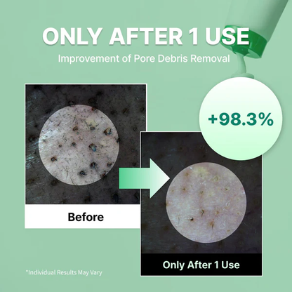 Centella Deep Pore Cleansing Foam