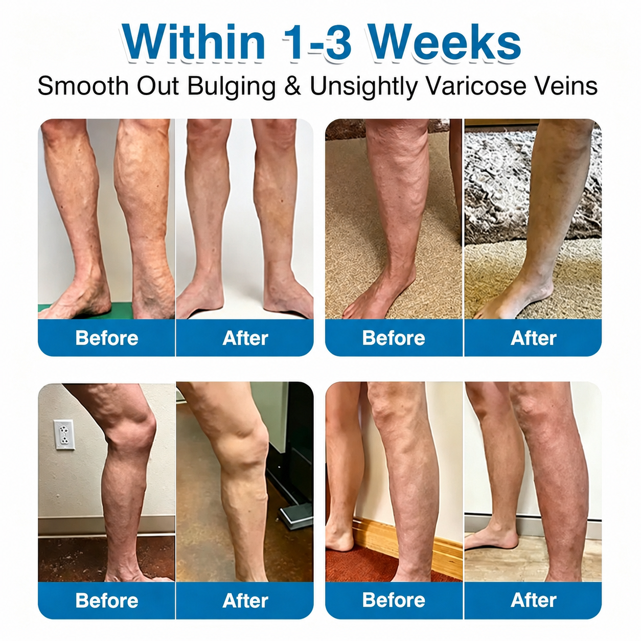 🏅🏃OUR+ Microneedle Patch Roll⚡Instant Relief, Long-Term Results