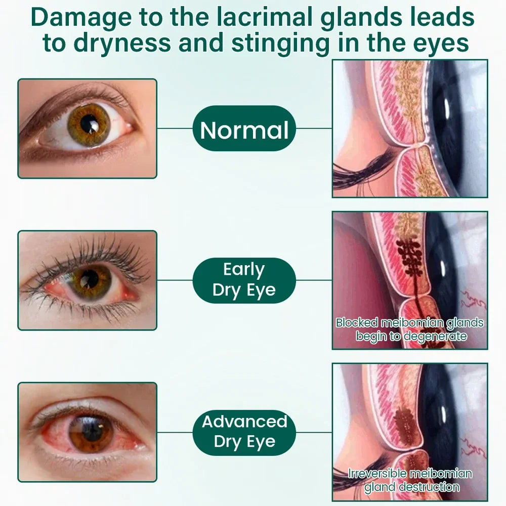 Ceoerty OptiClear Nano Eye Roller Serum