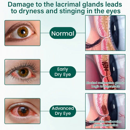 Ceoerty OptiClear Nano Eye Roller Serum