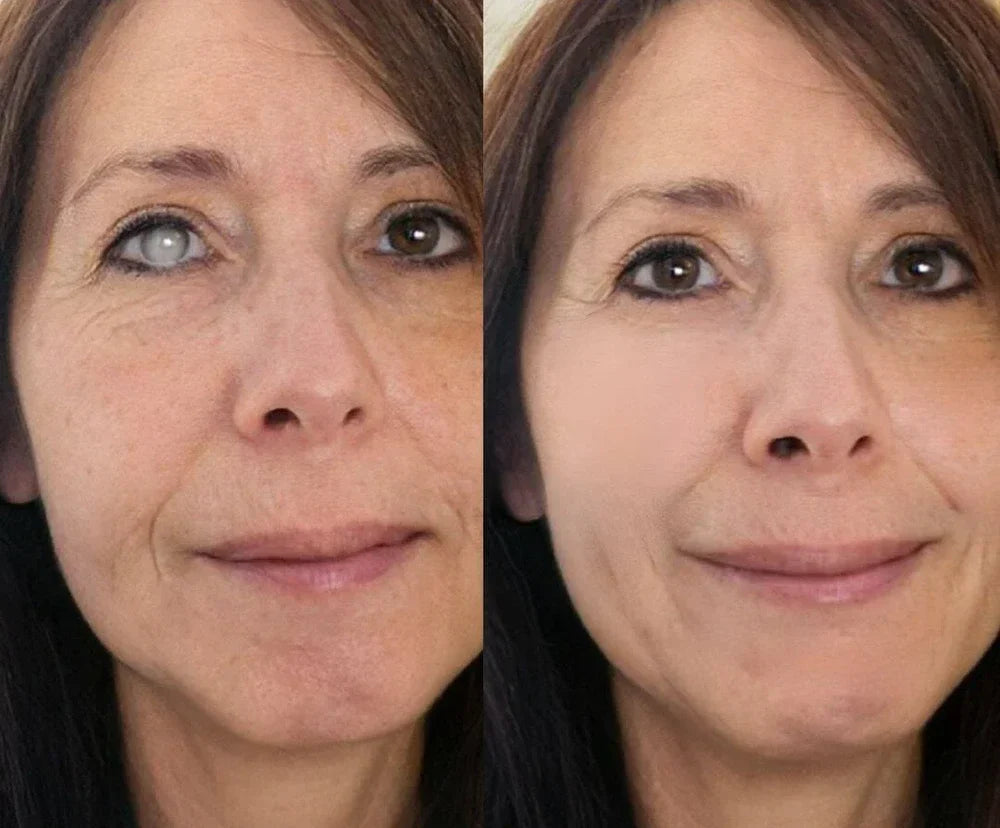 Ceoerty OptiClear Nano Eye Roller Serum