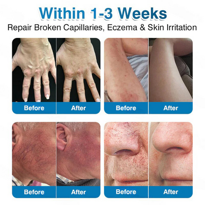 🏅🏃OUR+ Microneedle Patch Roll⚡Instant Relief, Long-Term Results