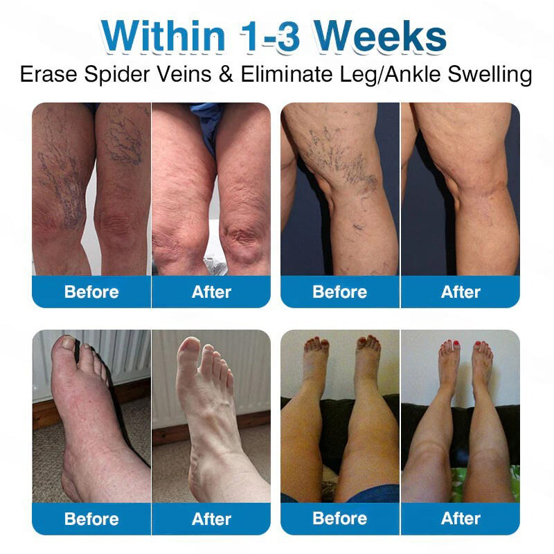 🏅🏃OUR+ Microneedle Patch Roll⚡Instant Relief, Long-Term Results