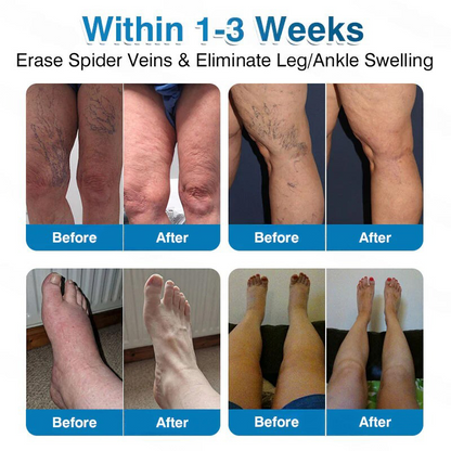 🏅🏃OUR+ Microneedle Patch Roll⚡Instant Relief, Long-Term Results