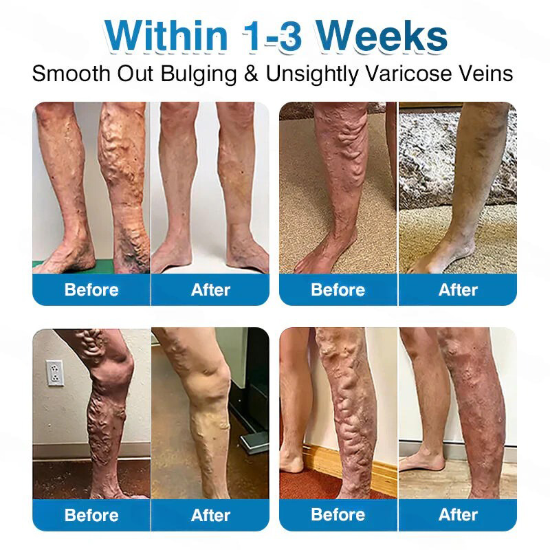 🏅🏃OUR+ Microneedle Patch Roll⚡Instant Relief, Long-Term Results