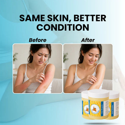 Repair Balm For Eczema & Psoriasis