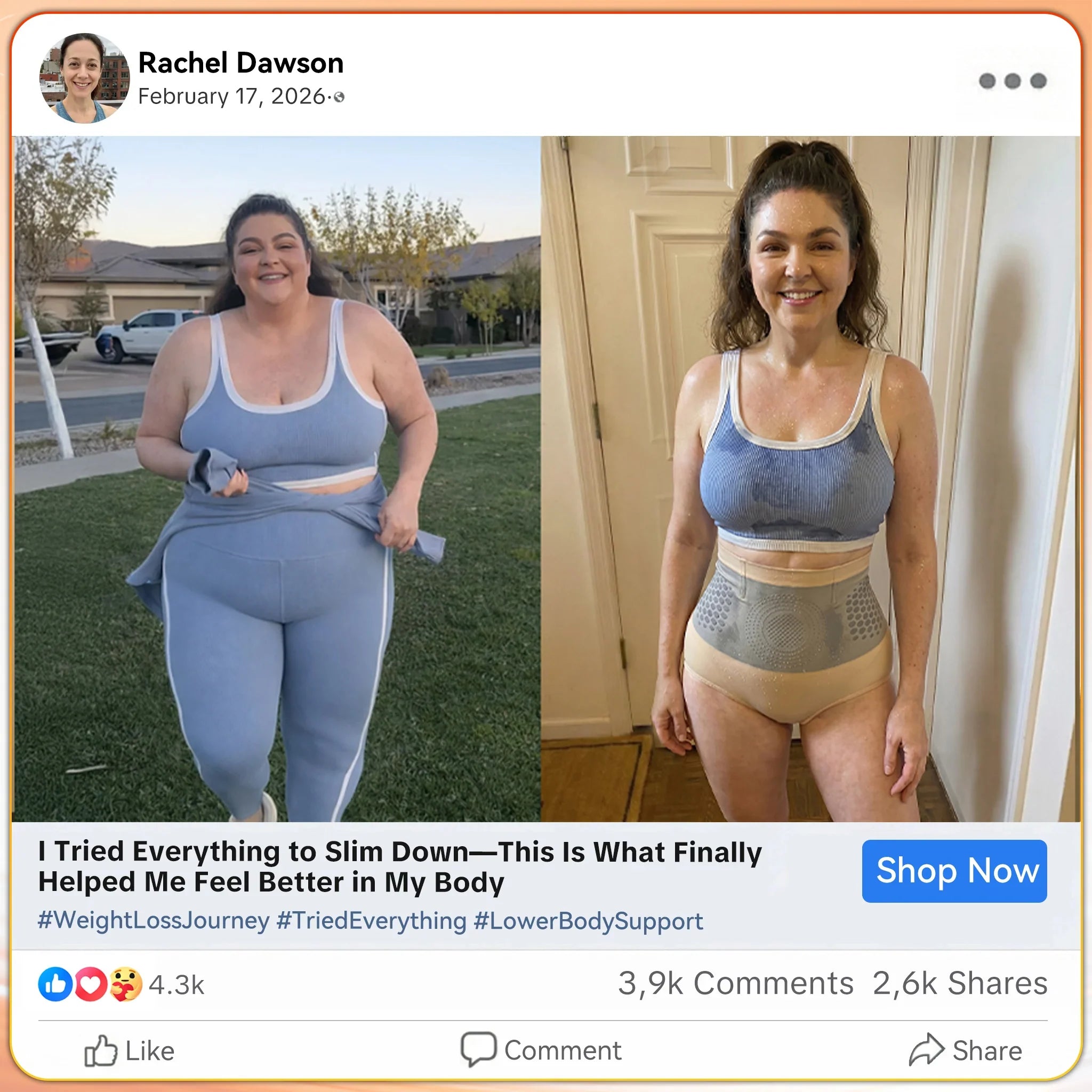 Before and after - Rachel D.