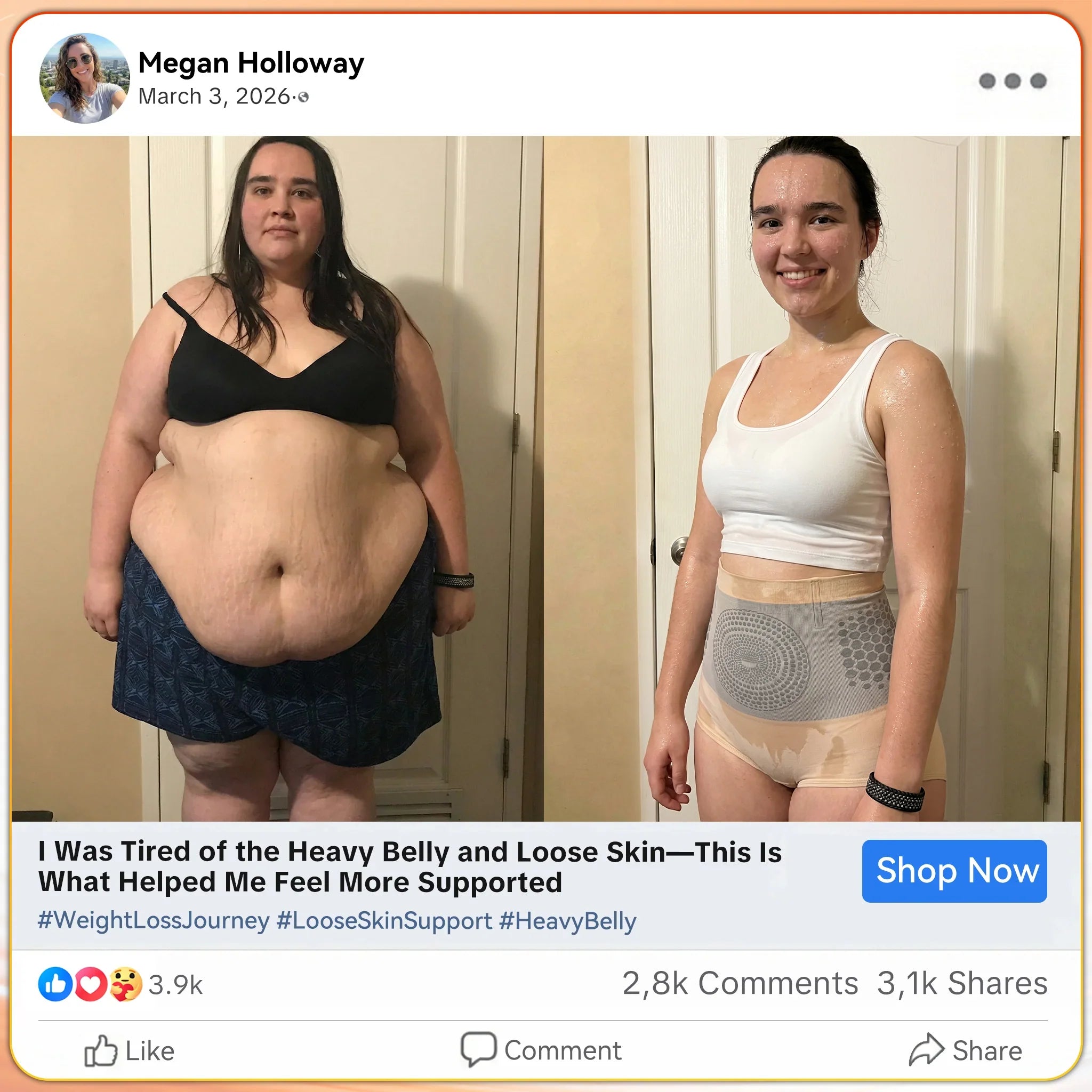 Before and after - Megan H.