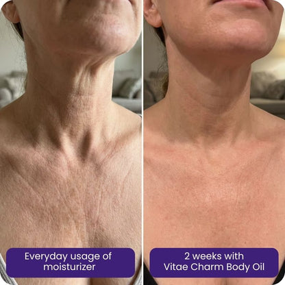 🔥LAST DAY 50% OFF -OUR+™ Body Oil