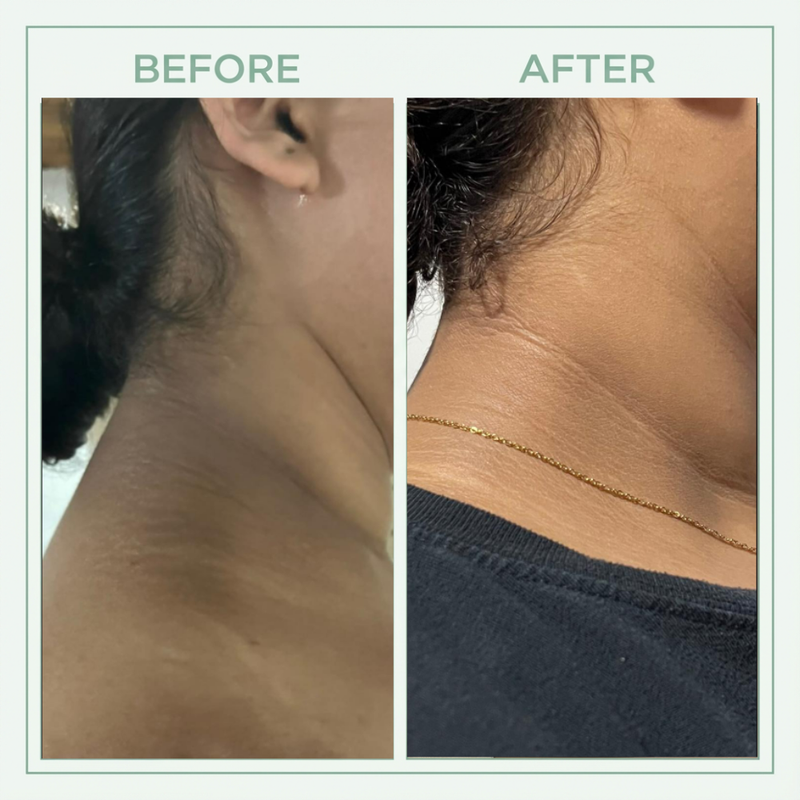 Tryourplus™  Brightening Set