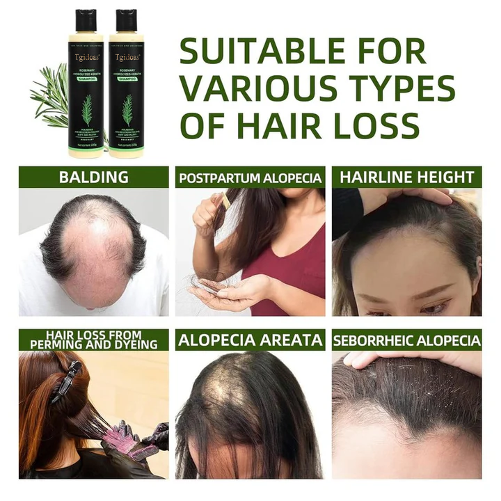 Tgidoas Rosemary Shampoo