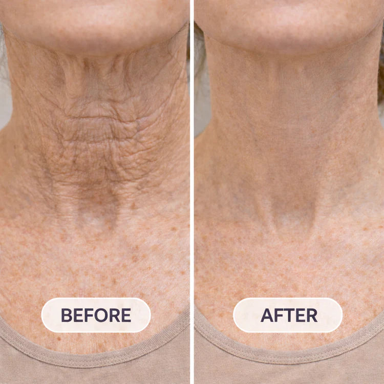 Before & After comparison