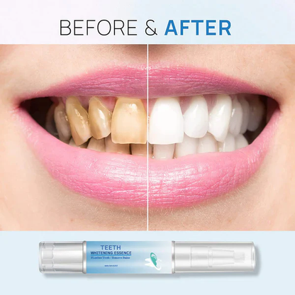 BUY 1 GET 1 FREE | Teeth Whitening Essence