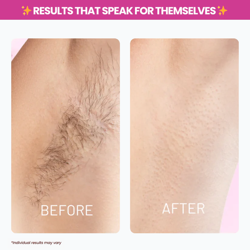 OUR+™ Cyperus Rotundus Oil