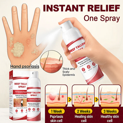 OUR+™ Beef Tallow Spray for Itchy, Flaky Psoriasis Skin