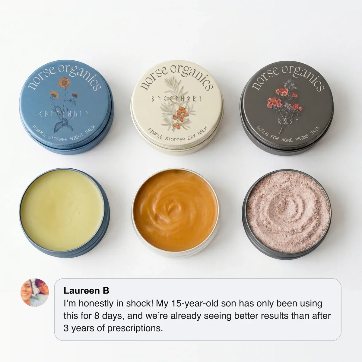 Kill Acne & Redness Ritual✨