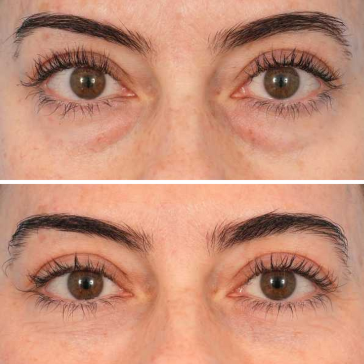 Customer before and after result