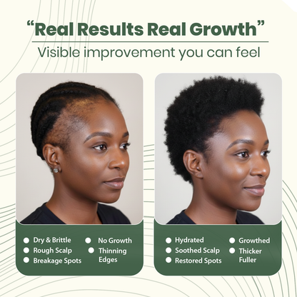 Batana Natural Hair Growth Oil