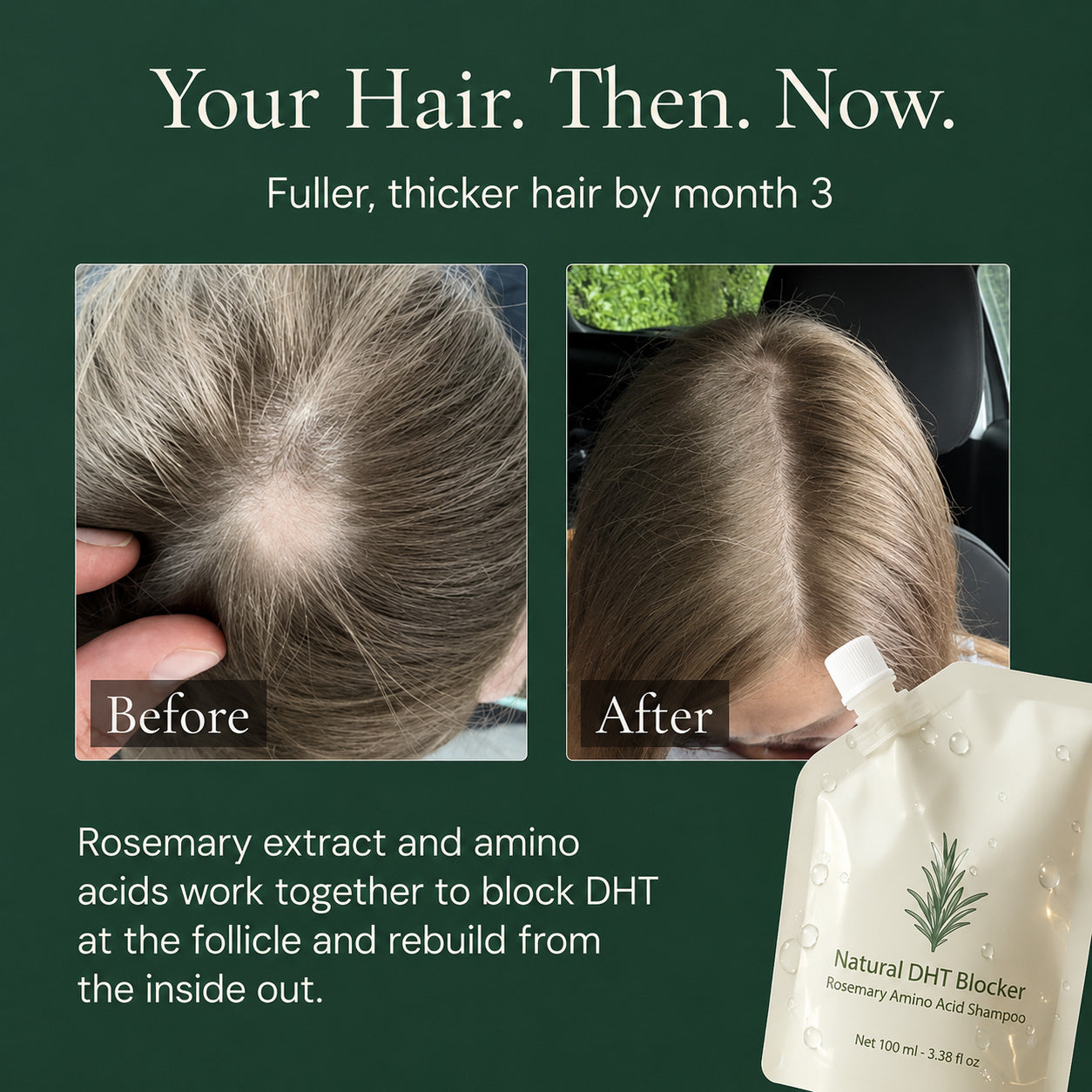 Rosemary Hair Growth Shampoo