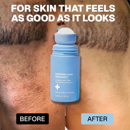 OUR+: Smoothing Solution For Ingrown Hairs