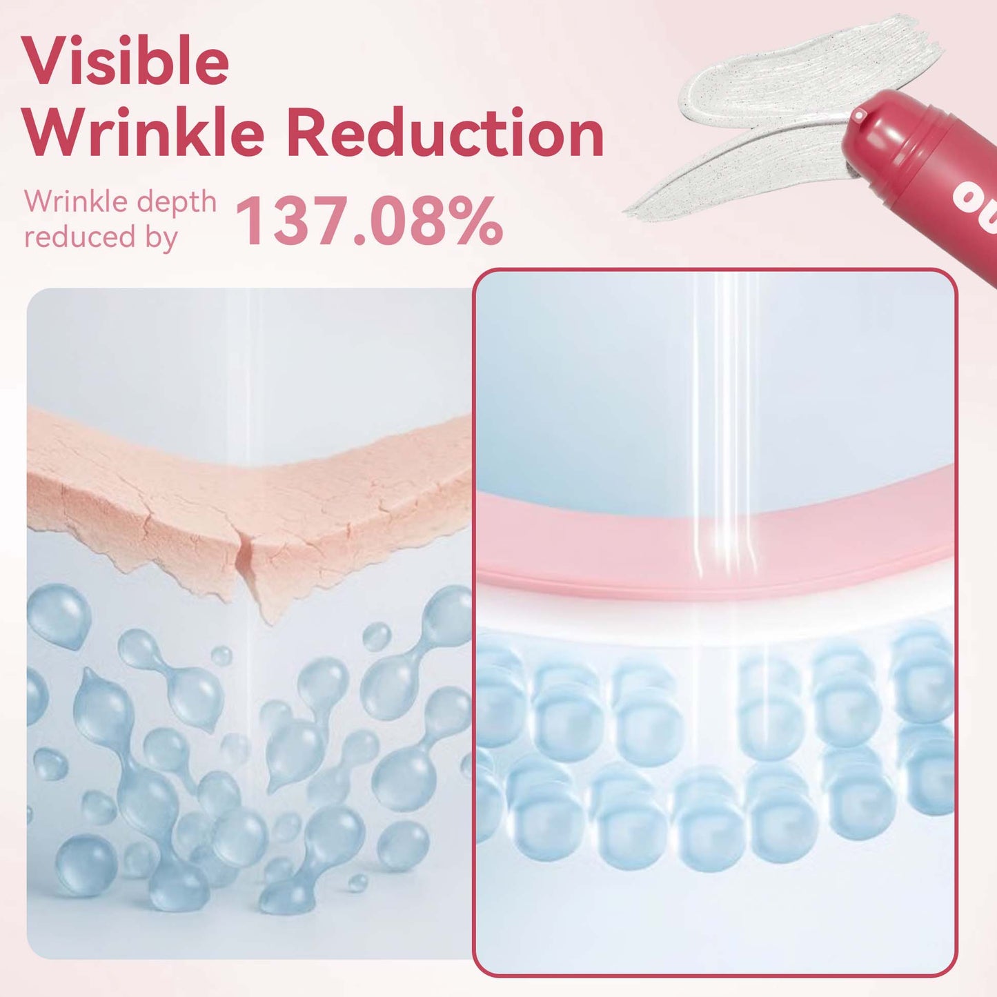 Reverse-aging Adaptive Foundation