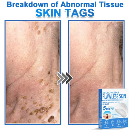 🎁 2-in-1 Microneedle & Hydrocolloid Patch | Raised Moles,Acne,  Flat Warts & Skin Tags Remover | Improves Wrinkles, Scars & Blemishes | Invisible Pimple Patches for Face & Body