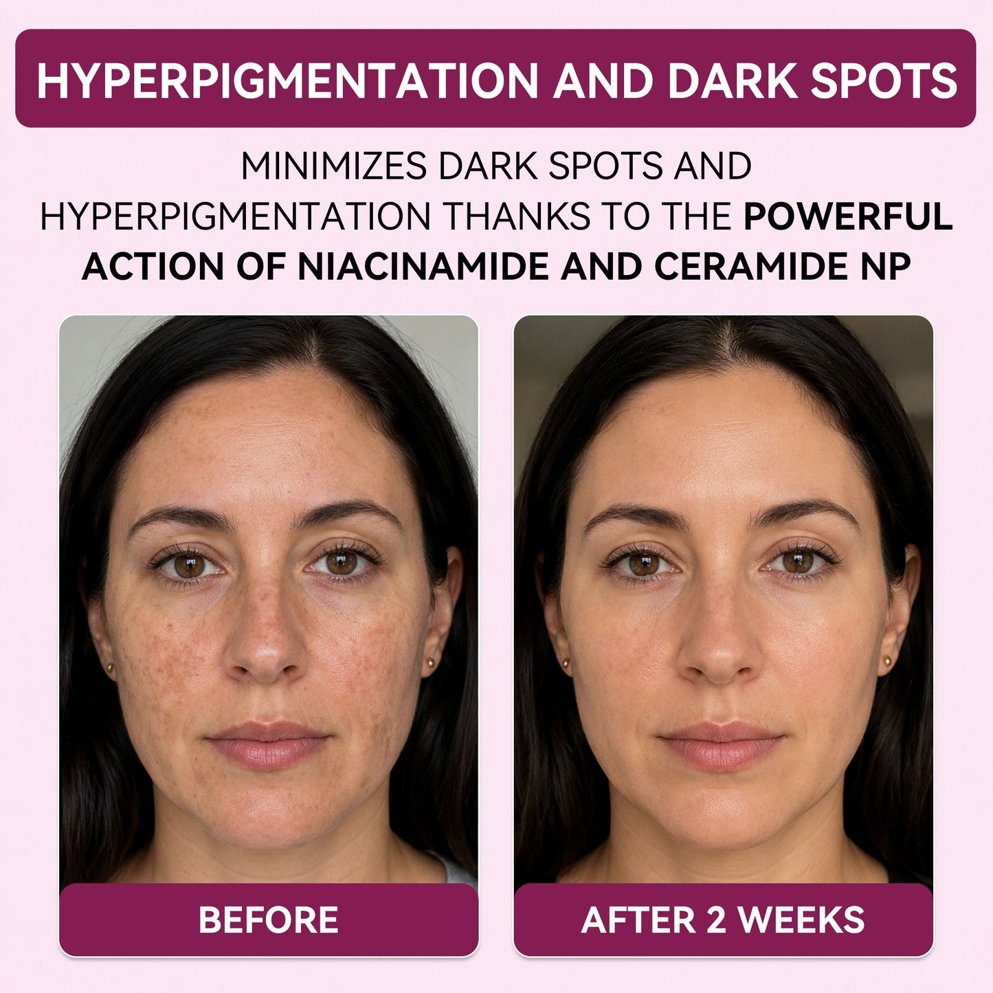 Regenerating Mask with Hydrolyzed Collagen and Niacinamide