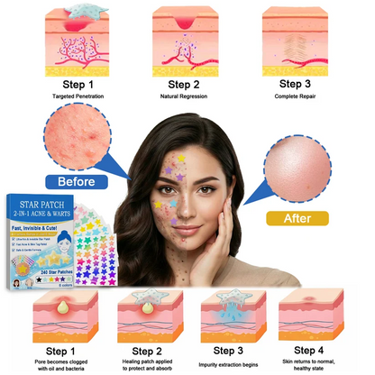 2-in-1 Microneedle & Hydrocolloid Star Patch 🌟 | Acne, Blackheads, Skin Tags & Raised Blemishes Remover 💫 | 6 Colors Pimple Patch for Face & Neck 🌸 | Invisible Star Zit Stickers ✨