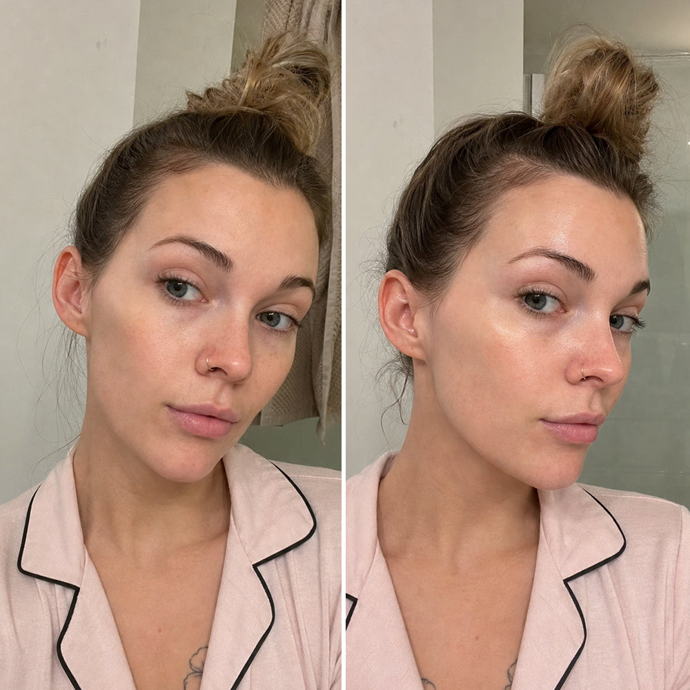 Skin before using ZAMORAES