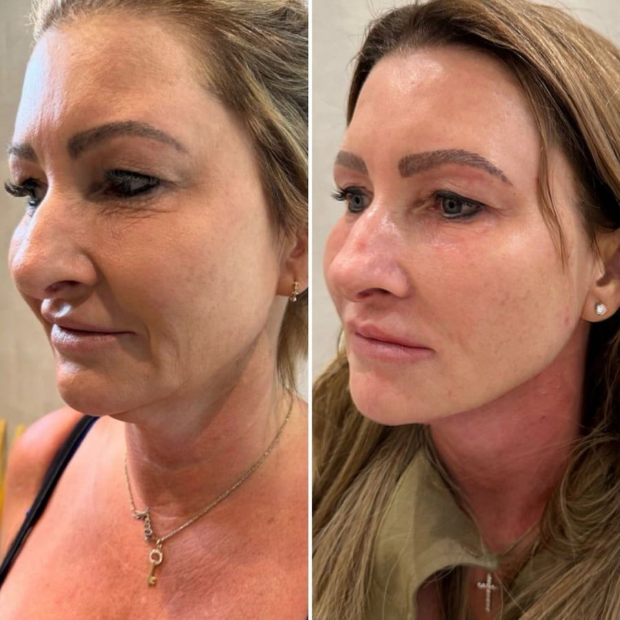Customer result