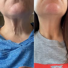 Customer review before and after image 1