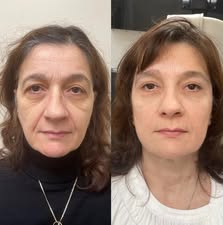 Customer review before and after image 2