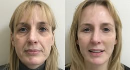 Customer review before and after image 3