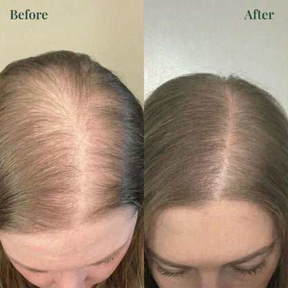 OUR+™ Growth-Support Shampoo - 2-Pack