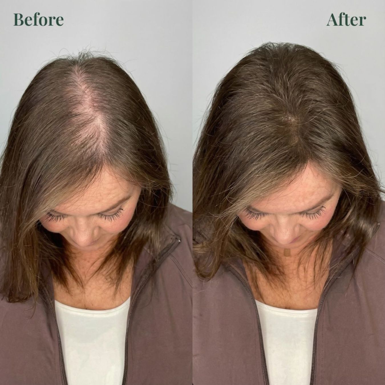 OUR+™ Growth-Support Shampoo - 2-Pack