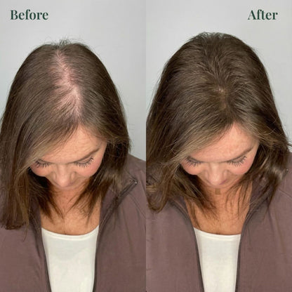 OUR+™ Growth-Support Shampoo - 2-Pack