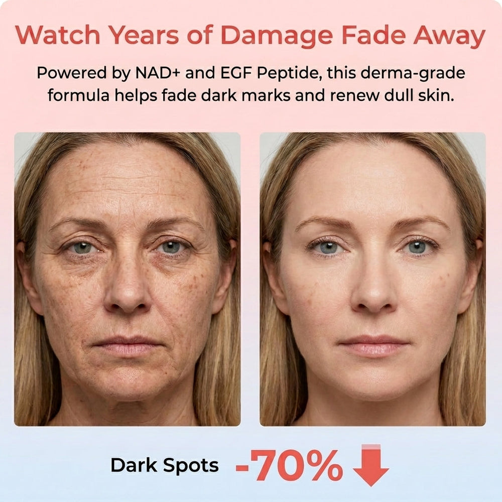 Dark Spots