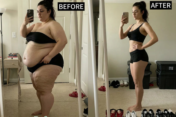 Weight Support - before after