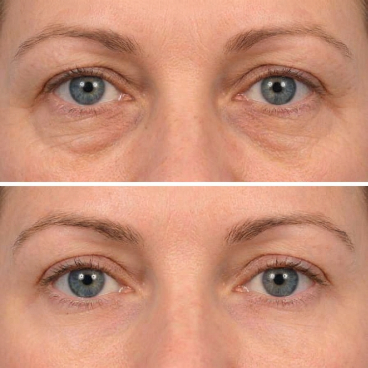 Customer before and after result