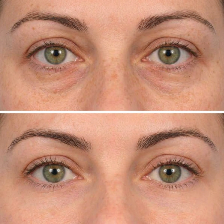 Customer before and after result
