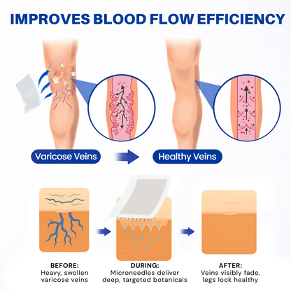 Vein ContourMicroneedle Patch with AdvancedDiosmin & Hesperidin Delivery 🌿 7-Day Visible Results for VaricoseVeins
