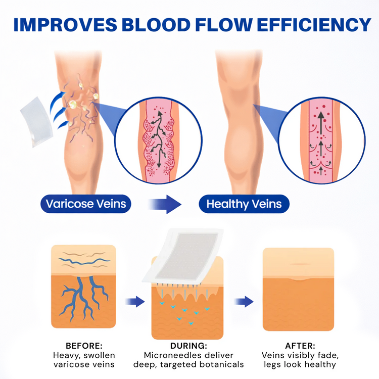 VitaCuroK™ -VeinTarget Microneedle Patch