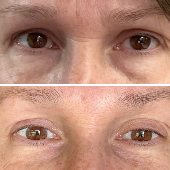 Customer before and after result