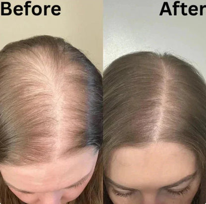Rosemary Hair Growth Shampoo