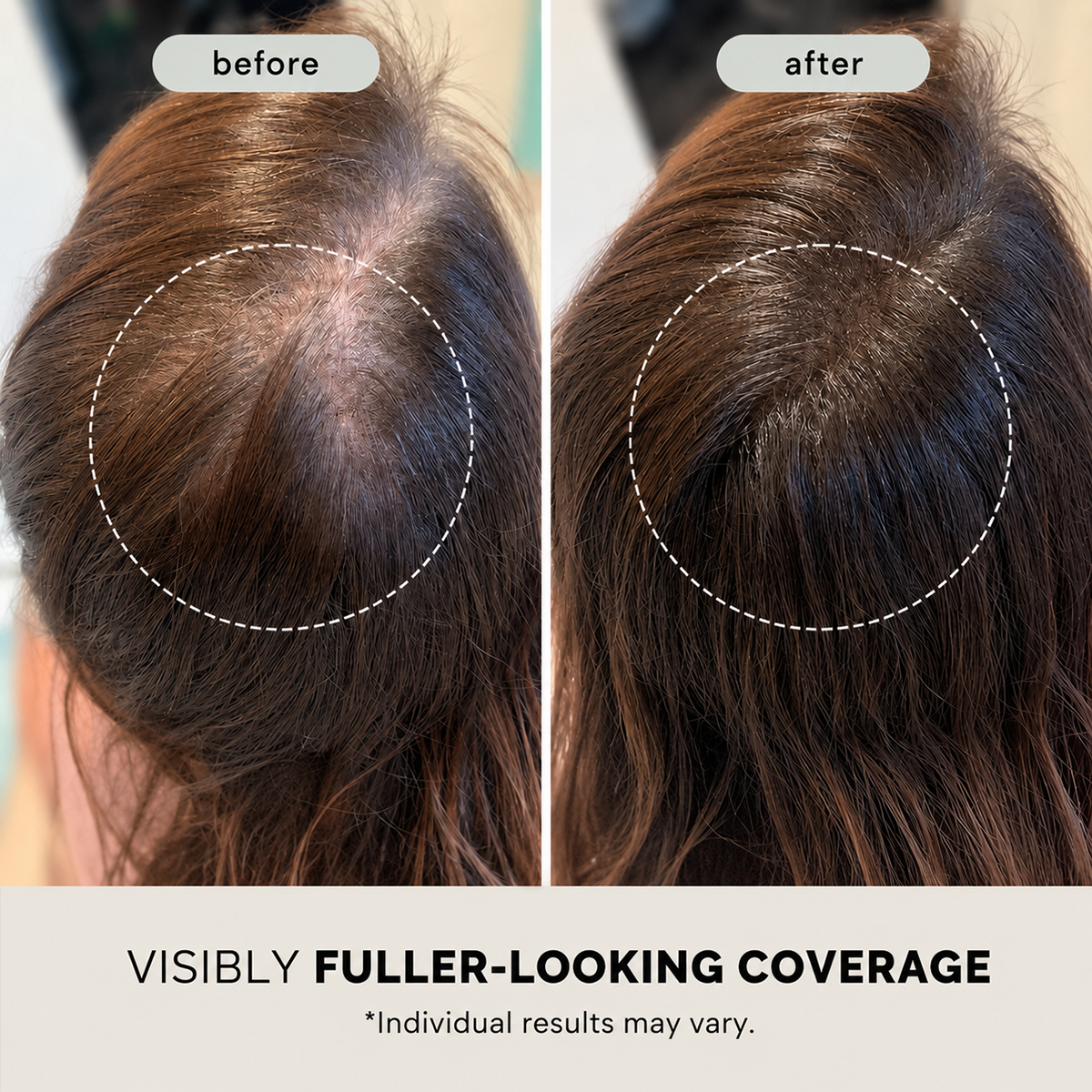 PDRN Reedle Shot Hair Brush Serum