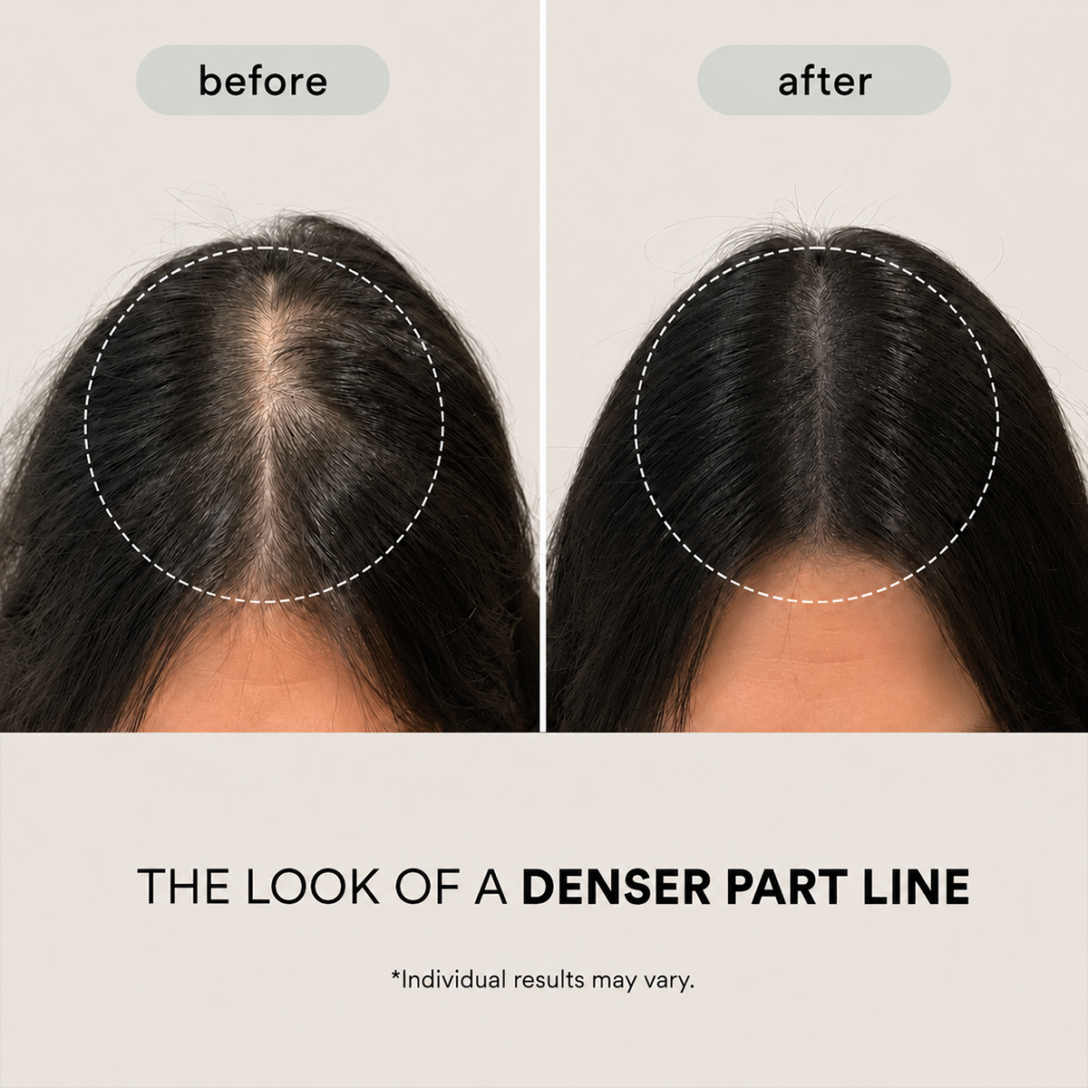 PDRN Reedle Shot Hair Brush Serum