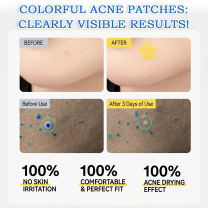 2-in-1 Microneedle & Hydrocolloid Star Patch 🌟 | Acne, Blackheads, Skin Tags & Raised Blemishes Remover 💫 | 6 Colors Pimple Patch for Face & Neck 🌸 | Invisible Star Zit Stickers ✨